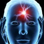 I batteri orali sono responsabili di ictus e ischemie