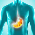 Reflusso gastroesofageo: curarlo con un massaggio