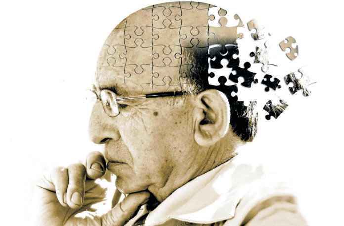 Alzheimer Alzheimer